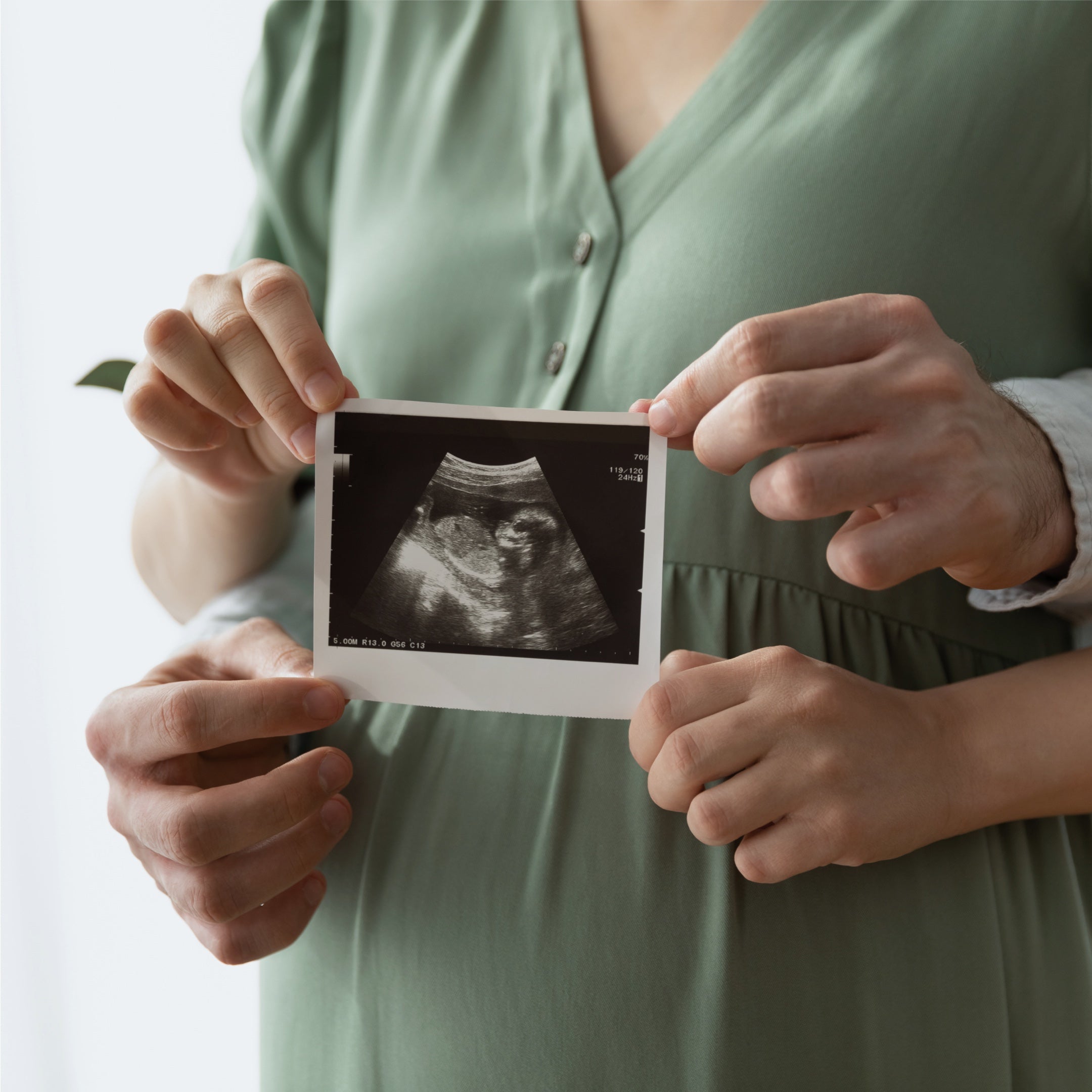 Bloom (fertilidad)